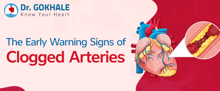 Early Warning Signs of Clogged Arteries | Dr Gokhale