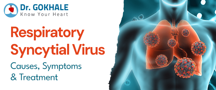Respiratory Syncytial Virus: Causes, Symptoms, and Treatment