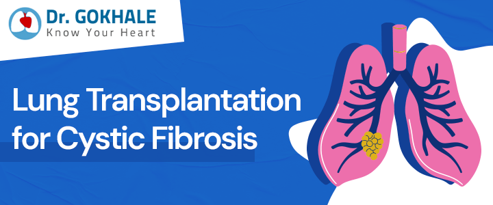 Cystic Fibrosis: Complications and Lung Transplant Treatment
