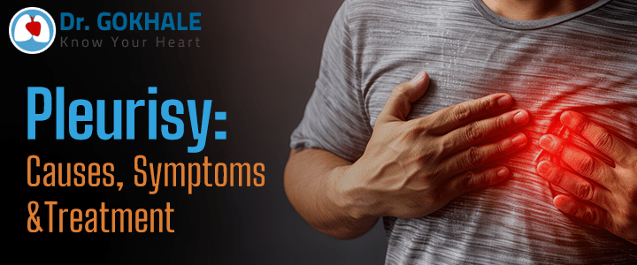 Pleurisy: Causes, Symptoms and Treatment