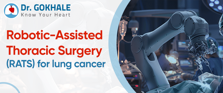 Robotic-Assisted Thoracic Surgery (RATS) For Lung Cancer