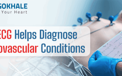 How ECG Helps Diagnose Cardiovascular Conditions?