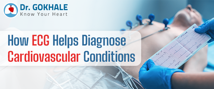 How-ECG-Helps-Diagnose-Cardiovascular-Conditions