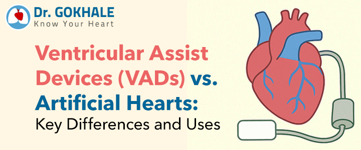 Ventricular Assist Devices (VADs) vs. Artificial Hearts: Key Differences and Uses