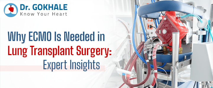 Why ECMO Is Needed in Lung Transplant Surgery: Expert Insights