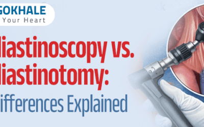 Mediastinoscopy vs. Mediastinotomy: Key Differences Explained