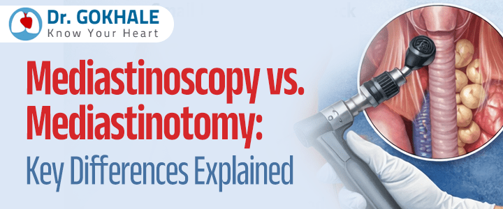 Mediastinoscopy vs. Mediastinotomy: Key Differences Explained