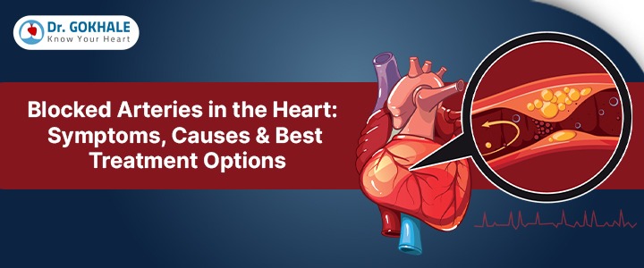 Blocked Arteries in the Heart: Symptoms, Causes & Best Treatment Options