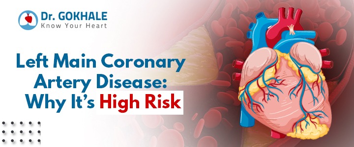 Left Main Coronary Artery Disease: Why It’s High Risk