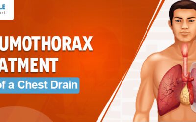 Pneumothorax Treatment: Role of a Chest Drain