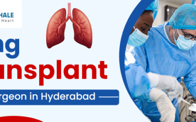 Lung Transplant Surgeon in Hyderabad: A Systematic Guide for Patients and Families