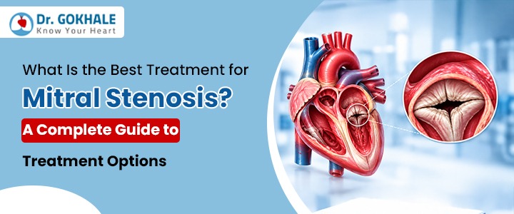 Best treatment options for mitral stenosis