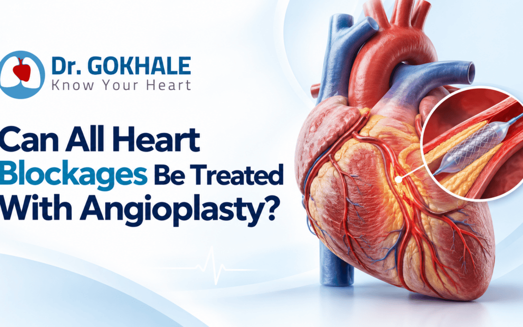 Can All Heart Blockages Be Treated With Angioplasty?